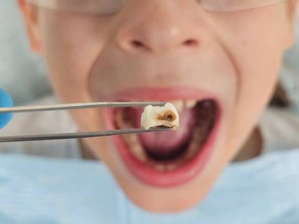 Best Walk-In Dentist Near Me  in St Louis, MI