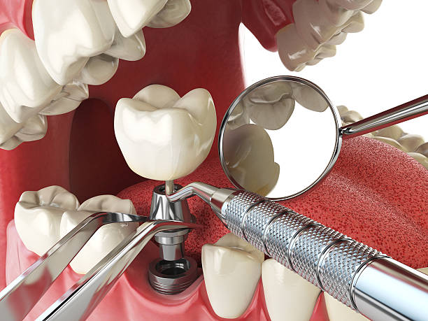  St Louis, MI Emergency Dentist Pros