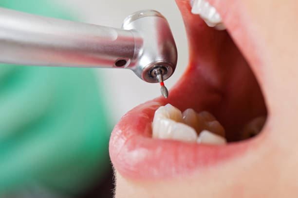 Best Emergency Dental Services Near Me  in St Louis, MI